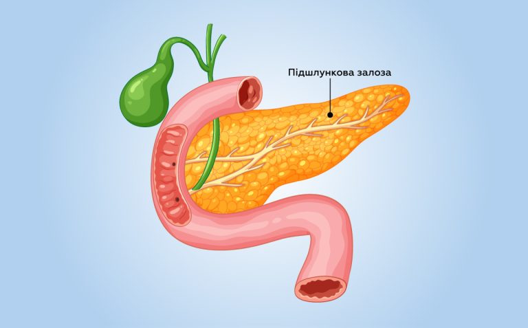 Харчування за панкреатиту