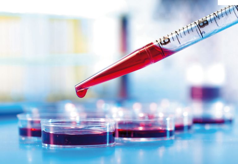 Кривава історія: про що розповість аналіз крові